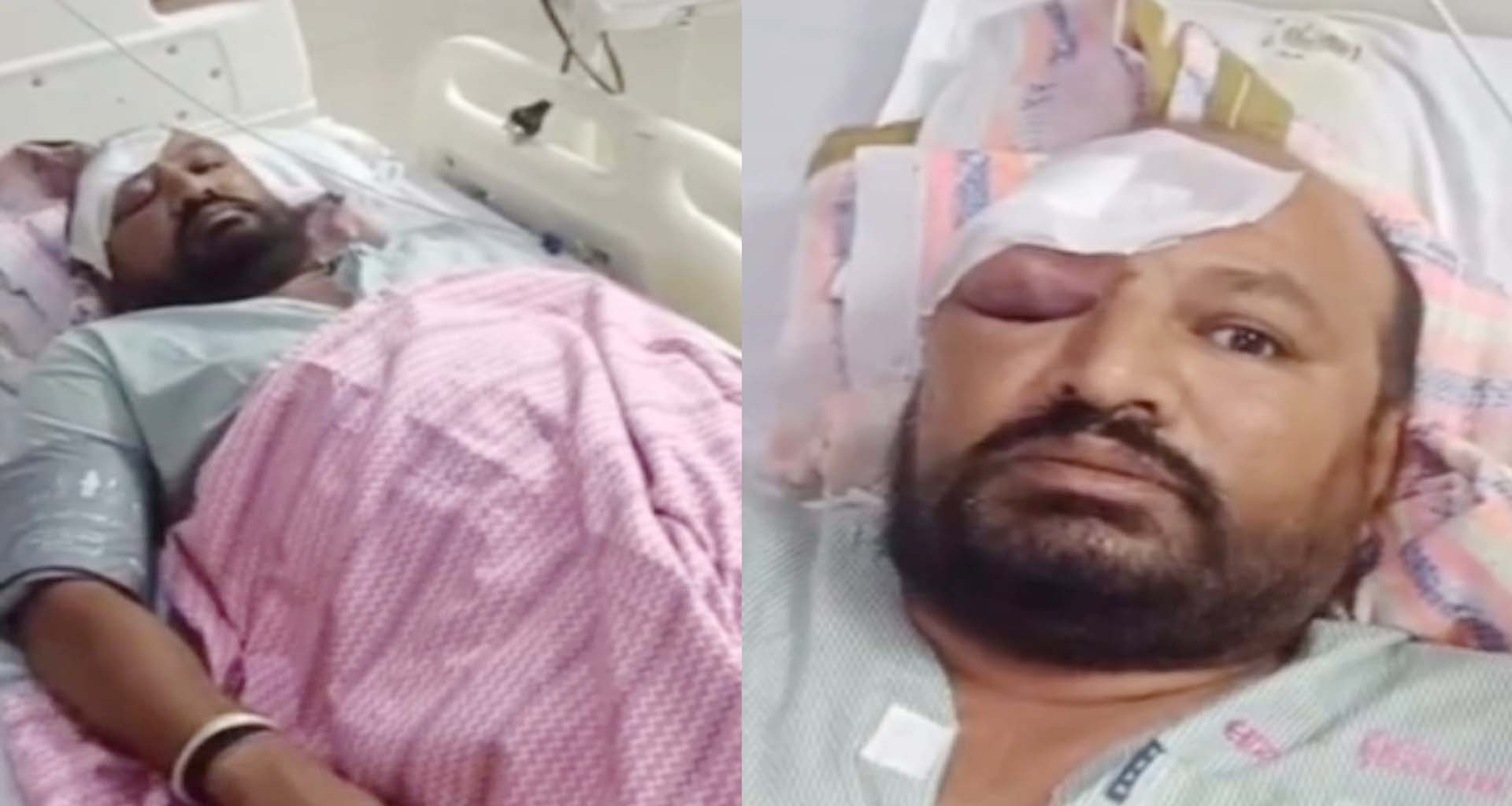 ચૂંટણી ગરમાઈ: મહેસાણા મગુના જિલ્લા પંચાયત બેઠક પર ભાજપના ઉમેદવાર પર હુમલો થતા ચકચાર