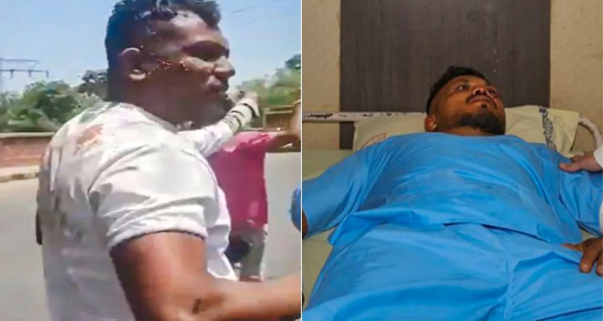 તે રાત્રે અચાનક ઊંઘમાંથી જાગી જાય છે, કોઈની સાથે વાત કરતો નથી', વિમાન દુર્ઘટનામાં બચી ગયેલા એકમાત્ર વ્યક્તિ વિશ્વાસ કુમાર હવે ક્યાં છે?