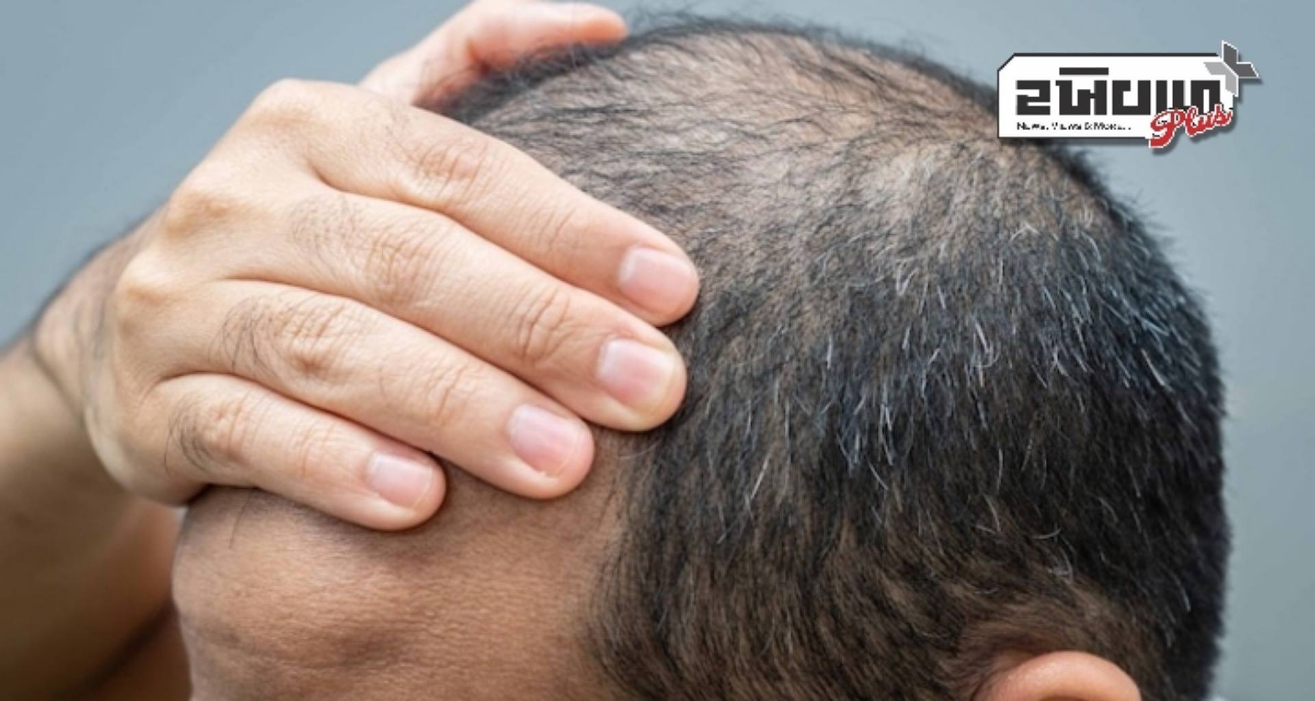 નિષ્ણાતો 1990 ના દાયકાની આ દવાને વાળના વિકાસ માટે એક સફળતા કેમ કહી રહ્યા છે? જાણો...