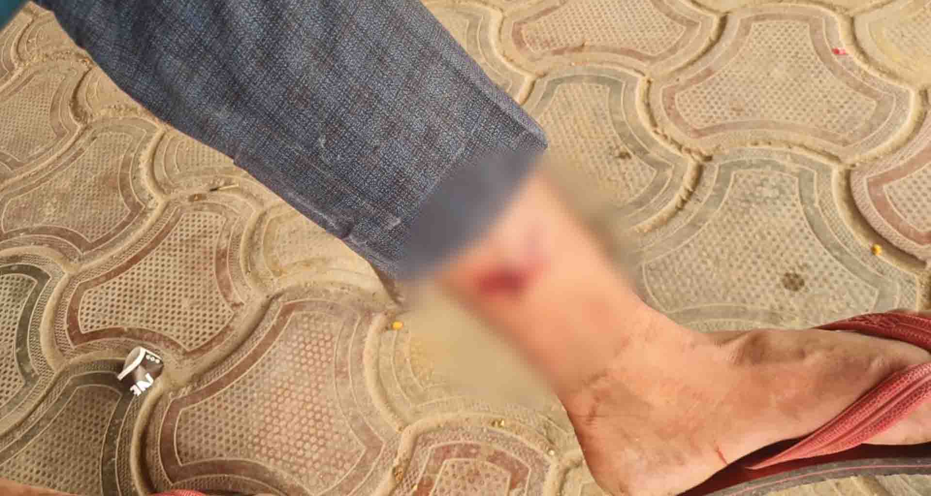 વાવ માં ફરી પાછો કપિરાજનો આંતક બે લોકો ને બચકાં ભર્યા સારવાર લેવાની ફરજ પડી