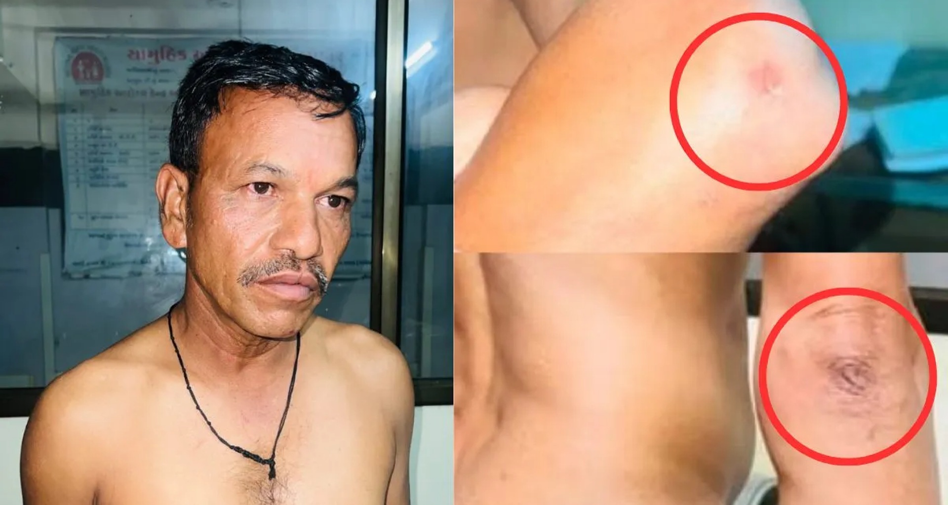 મહિસાગરમાં પોલીસ બર્બરતાનો મામલો; મહિલા PSI એ આદિવાસી પુરુષને નિર્દયતાથી માર માર્યો