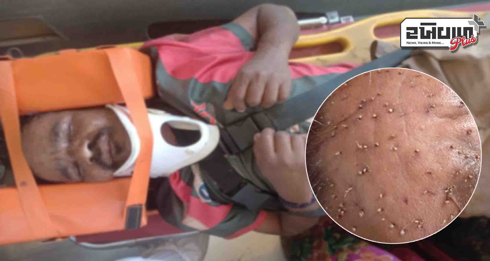 છાપી ૧૦૮ ટીમની આગવી સૂઝબૂઝથી દર્દીને ઝેરી મધમાખીના ઝુંડમાંથી દર્દીને બચાવ્યું