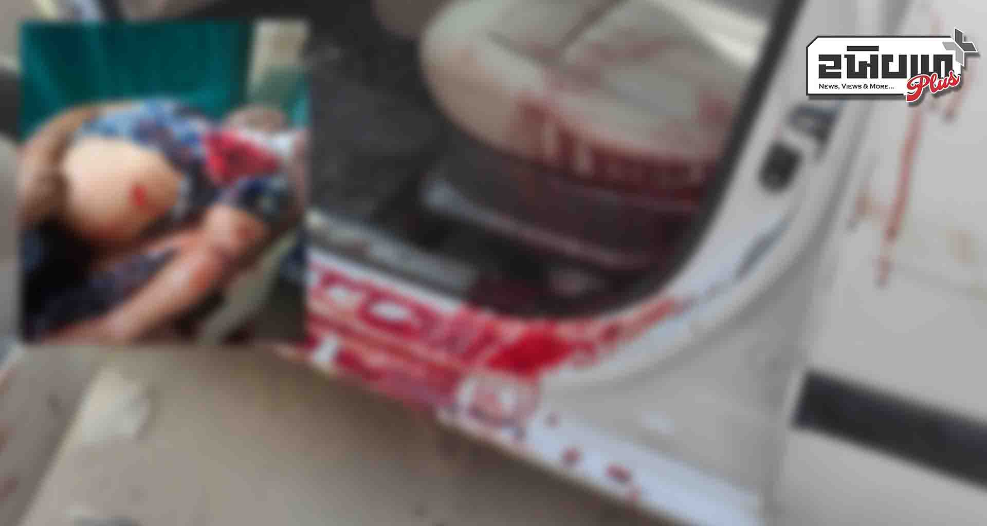 હડાદમાં અંગત અદાવતમાં યુવક પર છરી વડે હુમલો; ઇજાગ્રસ્તને સારવાર અર્થે પાલનપુર ખસેડાયો