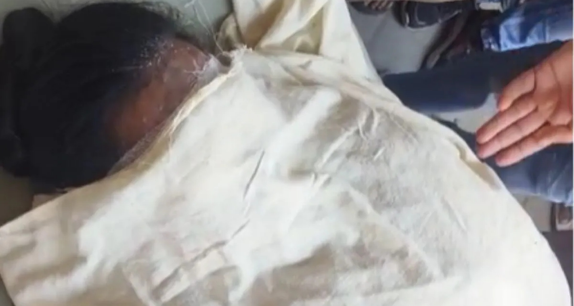 યુપી: સંભલમાં ધોળા દિવસે મહિલા શિક્ષિકા પર એસિડ હુમલો; થોડા દિવસોમાં લગ્ન થવાના છે, આરોપી ફરાર