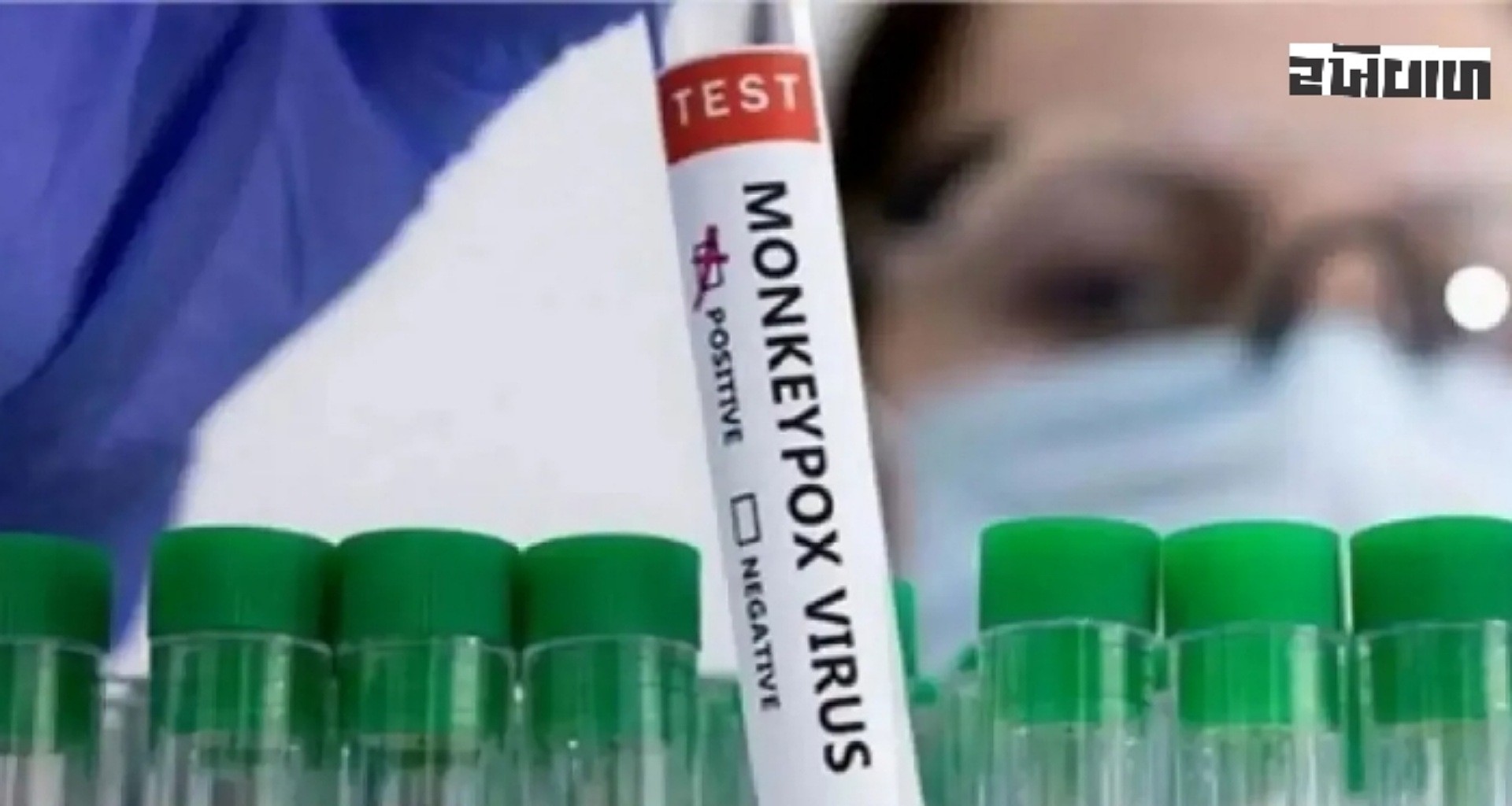 ભારતના આ રાજ્યમાં મળ્યો 'મંકીપોક્સ'નો કેસ, દુબઈથી આવેલા વ્યક્તિને લાગ્યો ચેપ